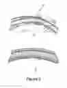 Fig. 06 - High compressor exit guide vane assembly to pre-diffuser junction