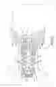 Fig. 18 - STEPPER MOTOR OPERATED BALANCED FLOW CONTROL VALVE