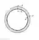 Fig. 01 - Lining hose, renovated pressure pipe and method for renovating a pressure pipe
