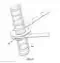 Fig. 06 - Tree topper with trunk attachable deformable conduit