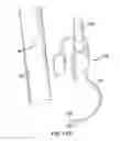 Fig. 13 - Tree topper with trunk attachable deformable conduit