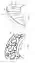 Fig. 07 - Gas turbine engine combustor bulkhead assembly