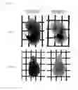 Fig. 02 - Method for rendering biological material transparent and processing kit for rendering biological material transparent