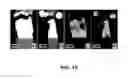Fig. 13 - Fixture for in situ electromigration testing during X-ray microtomography