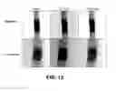 Fig. 15 - Fixture for in situ electromigration testing during X-ray microtomography