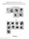 Fig. 16 - Flowcell systems and methods for particle analysis in blood samples