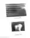 Fig. 15 - NANOTIPPED DEVICE AND METHOD