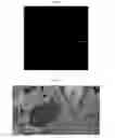 Fig. 03 - Method for diagnosis of diseases using morphological characteristics of luterial