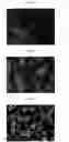 Fig. 05 - Method for diagnosis of diseases using morphological characteristics of luterial