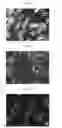 Fig. 06 - Method for diagnosis of diseases using morphological characteristics of luterial
