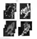 Fig. 08 - Method for diagnosis of diseases using morphological characteristics of luterial