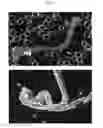 Fig. 09 - Method for diagnosis of diseases using morphological characteristics of luterial