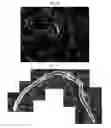 Fig. 14 - Method for diagnosis of diseases using morphological characteristics of luterial