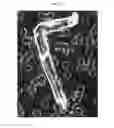 Fig. 16 - Method for diagnosis of diseases using morphological characteristics of luterial