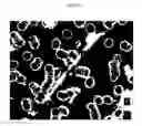 Fig. 17 - Method for diagnosis of diseases using morphological characteristics of luterial