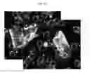 Fig. 20 - Method for diagnosis of diseases using morphological characteristics of luterial