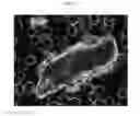 Fig. 23 - Method for diagnosis of diseases using morphological characteristics of luterial