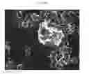 Fig. 27 - Method for diagnosis of diseases using morphological characteristics of luterial