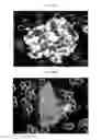 Fig. 31 - Method for diagnosis of diseases using morphological characteristics of luterial