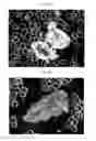 Fig. 32 - Method for diagnosis of diseases using morphological characteristics of luterial