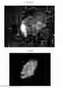 Fig. 34 - Method for diagnosis of diseases using morphological characteristics of luterial