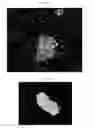 Fig. 35 - Method for diagnosis of diseases using morphological characteristics of luterial