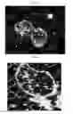Fig. 36 - Method for diagnosis of diseases using morphological characteristics of luterial