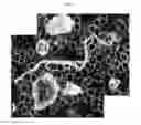 Fig. 40 - Method for diagnosis of diseases using morphological characteristics of luterial