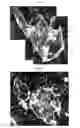 Fig. 41 - Method for diagnosis of diseases using morphological characteristics of luterial