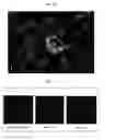 Fig. 42 - Method for diagnosis of diseases using morphological characteristics of luterial
