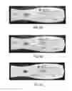 Fig. 09 - Test apparatus and methods for ST2 cardiac biomarker