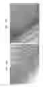 Fig. 16 - Sensor chip, detection system, and method of detecting target substance in analyte