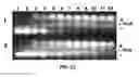 Fig. 23 - Detection of degradative enzymes and biomolecules in bodily fluids