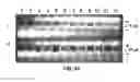 Fig. 25 - Detection of degradative enzymes and biomolecules in bodily fluids