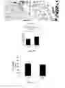 Fig. 06 - Methods for Predicting and Treating Bone Metastases in Prostate Cancer Patients