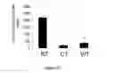 Fig. 07 - Methods for Predicting and Treating Bone Metastases in Prostate Cancer Patients