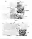 Fig. 14 - Methods for Predicting and Treating Bone Metastases in Prostate Cancer Patients