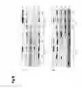 Fig. 13 - ASSAY METHODS FOR THE DETERMINATION OF FKBPL EXPRESSION LEVEL IN THE CONTEXT OF BREAST CANCER