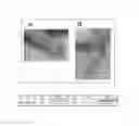 Fig. 02 - METHODS FOR IDENTIFYING AUTOIMMUNE ARTHRITIS AND FOR SCREENING FOR INHIBITOR OF ACTIVATION OF AUTOIMMUNE ARTHRITOGENIC T CELLS