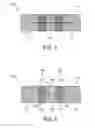 Fig. 03 - Laminate design-based radio frequency coil unit for MRI