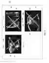 Fig. 03 - METHOD AND SYSTEM FOR CARDIAC SCAN PLANE PRESCRIPTION
