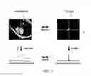 Fig. 04 - Apparatus and method for magnetic resonance imaging with high spatial temporal resolutions