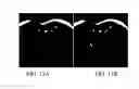 Fig. 16 - Apparatus and method for magnetic resonance imaging with high spatial temporal resolutions