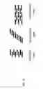 Fig. 06 - Stereo viewing device