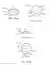 Fig. 20 - Conformable therapeutic shield for vision and pain