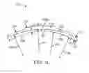 Fig. 32 - Conformable therapeutic shield for vision and pain