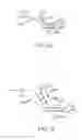 Fig. 42 - Conformable therapeutic shield for vision and pain
