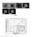 Fig. 06 - Superconducting Fiber and Efficient Cryogenic Cooling