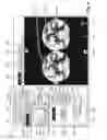 Fig. 04 - Method and device for displaying a first image and a second image of an object