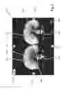 Fig. 06 - Method and device for displaying a first image and a second image of an object